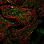Immunofluorescent staining of human cell line U-2 OS shows localization to nucleoplasm, cytosol & actin filaments.