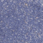 Immunohistochemical staining of human lymph node shows no positivity in non-germinal center cells as expected.