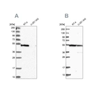 Western blot analysis using Anti-RASSF9 antibody HPA039428 (A) shows similar pattern to independent antibody HPA039678 (B).