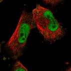 Anti-MTA3 Antibody