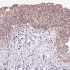 Anti-TPT1 Antibody