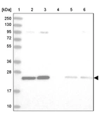 Lane 1: Marker [kDa] 250, 130, 95, 72, 55, 36, 28, 17, 10_br/_Lane 2: Human cell line RT-4_br/_Lane 3: Human cell line U-251 MG_br/_Lane 4: Human plasma_br/_Lane 5: Human Liver tissue_br/_Lane 6: Human Tonsil tissue