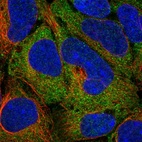 Immunofluorescent staining of human cell line HEK 293 shows localization to cytosol.