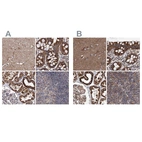 Anti-SUCLA2 Antibody