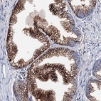 Anti-MED13L Antibody