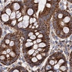 Immunohistochemical staining of human colon using Anti-SUCLA2 antibody HPA039435.