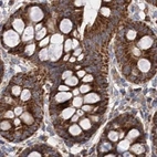 Immunohistochemical staining of human colon using Anti-SUCLA2 antibody HPA039435.