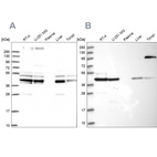 Western blot analysis using Anti-SUCLA2 antibody HPA039435 (A) shows similar pattern to independent antibody HPA039536 (B).