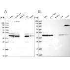 Western blot analysis using Anti-SUCLA2 antibody HPA039435 (A) shows similar pattern to independent antibody HPA039536 (B).