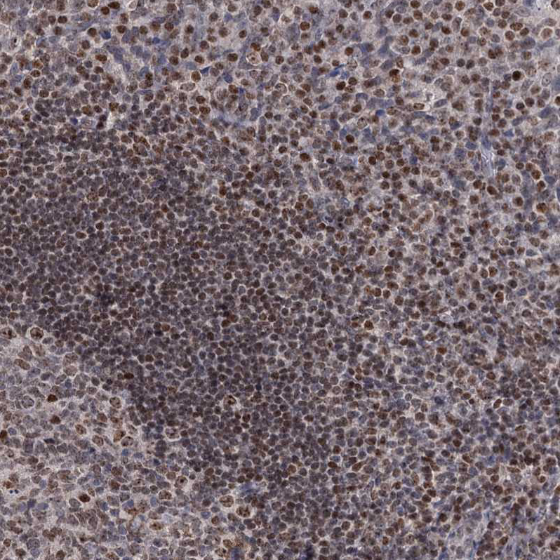 Anti-SMCHD1 Antibody