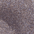 Anti-SMCHD1 Antibody