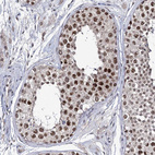 Immunohistochemical staining of human Testis shows moderate nuclear positivity in cells in seminiferous ducts.