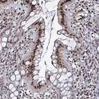 Immunohistochemical staining of human Rectum shows moderate nuclear positivity in glandular cells.