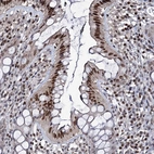 Immunohistochemical staining of human Rectum shows moderate nuclear positivity in glandular cells.