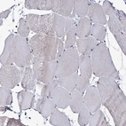 Immunohistochemical staining of human Skeletal muscle shows very weak nuclear positivity in myocytes.