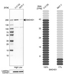 Western blot analysis in human cell lines U2OS and MCF-7 using Anti-SMCHD1 antibody. Corresponding SMCHD1 RNA-seq data are presented for the same cell lines. Loading control: Anti-HDAC1.