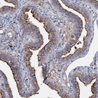 Anti-MANSC4 Antibody