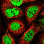 Immunofluorescent staining of human cell line U-2 OS shows localization to nucleoplasm.