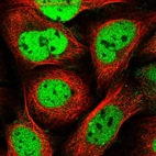 Immunofluorescent staining of human cell line U-2 OS shows localization to nucleoplasm.