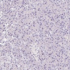 Immunohistochemical staining of human pancreas shows low expression as expected.