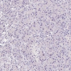 Immunohistochemical staining of human pancreas shows low expression as expected.