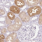 Immunohistochemical staining of human kidney shows high expression.