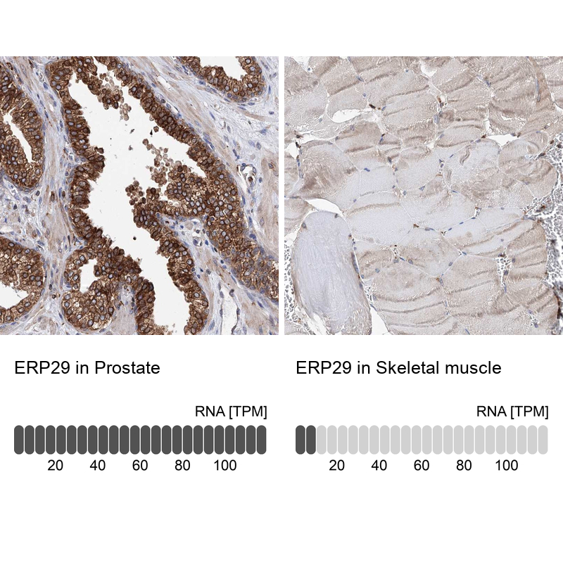 Anti-ERP29 Antibody