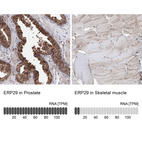 Anti-ERP29 Antibody