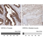 Anti-ERP29 Antibody
