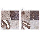 Immunohistochemical staining of human cerebral cortex, lymph node, prostate and skeletal muscle using Anti-ERP29 antibody HPA039456 (A) shows similar protein distribution across tissues to independent antibody HPA039363 (B).