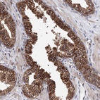 Immunohistochemical staining of human prostate shows high expression.