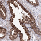 Anti-ERP29 Antibody
