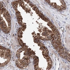 Immunohistochemical staining of human prostate shows high expression.