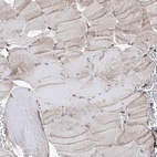 Immunohistochemical staining of human skeletal muscle shows low expression as expected.