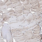 Immunohistochemical staining of human skeletal muscle shows low expression as expected.