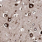 Immunohistochemical staining of human cerebral cortex using Anti-ERP29 antibody HPA039456.