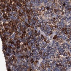 Immunohistochemical staining of human lymph node using Anti-ERP29 antibody HPA039456.