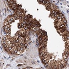 Immunohistochemical staining of human prostate using Anti-ERP29 antibody HPA039456.