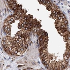 Immunohistochemical staining of human prostate using Anti-ERP29 antibody HPA039456.