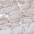 Immunohistochemical staining of human skeletal muscle using Anti-ERP29 antibody HPA039456.