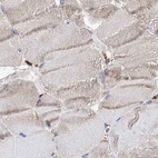 Immunohistochemical staining of human skeletal muscle using Anti-ERP29 antibody HPA039456.
