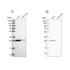 Western blot analysis using Anti-ERP29 antibody HPA039456 (A) shows similar pattern to independent antibody HPA039363 (B).