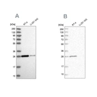 Western blot analysis using Anti-ERP29 antibody HPA039456 (A) shows similar pattern to independent antibody HPA039363 (B).