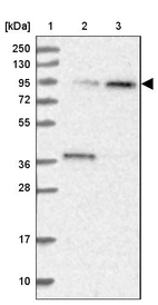 Lane 1: Marker [kDa] 250, 130, 95, 72, 55, 36, 28, 17, 10_br/_Lane 2: Human cell line RT-4_br/_Lane 3: Human cell line U-251MG sp