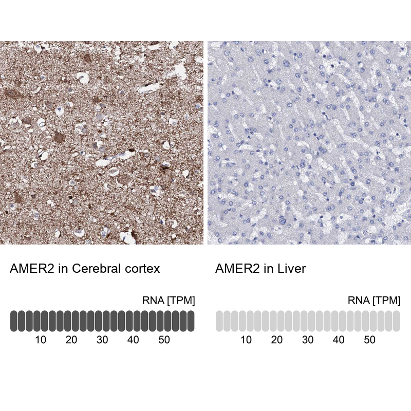 Anti-AMER2 Antibody