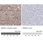 Anti-AMER2 Antibody