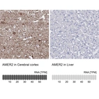 Anti-AMER2 Antibody