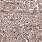Immunohistochemical staining of human cerebral cortex shows strong positivity in neuropil.