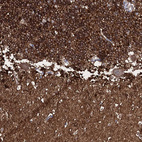 Immunohistochemical staining of human cerebellum shows strong positivity in neuropil.