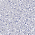 Immunohistochemical staining of human liver shows no positivity in hepatocytes as expected.